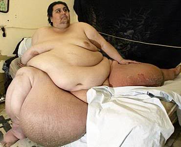 Name:  gotelaphantitis.jpg
Views: 35
Size:  18.7 KB